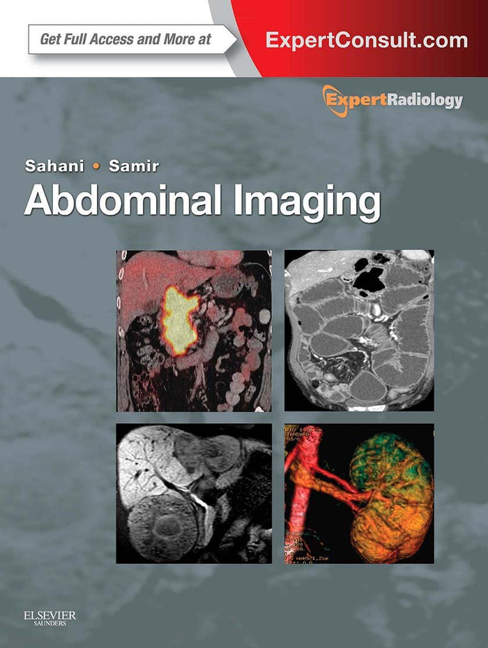 Abdominal Imaging, 2-Volume Set: Expert Radiology Series (Expert Consult: Online and Print) by Dushyant V Sahani MD - Hardcover cover