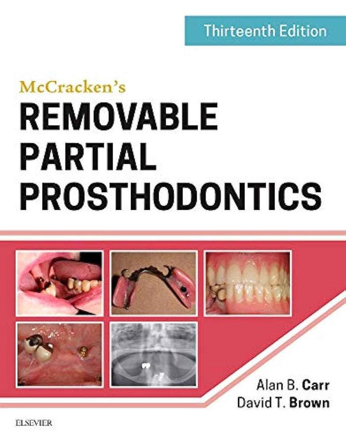 McCracken's Removable Partial Prosthodontics (13th Edition) by Alan B. Carr & David T. Brown – Hardcover (ISBN: 9780323339902)